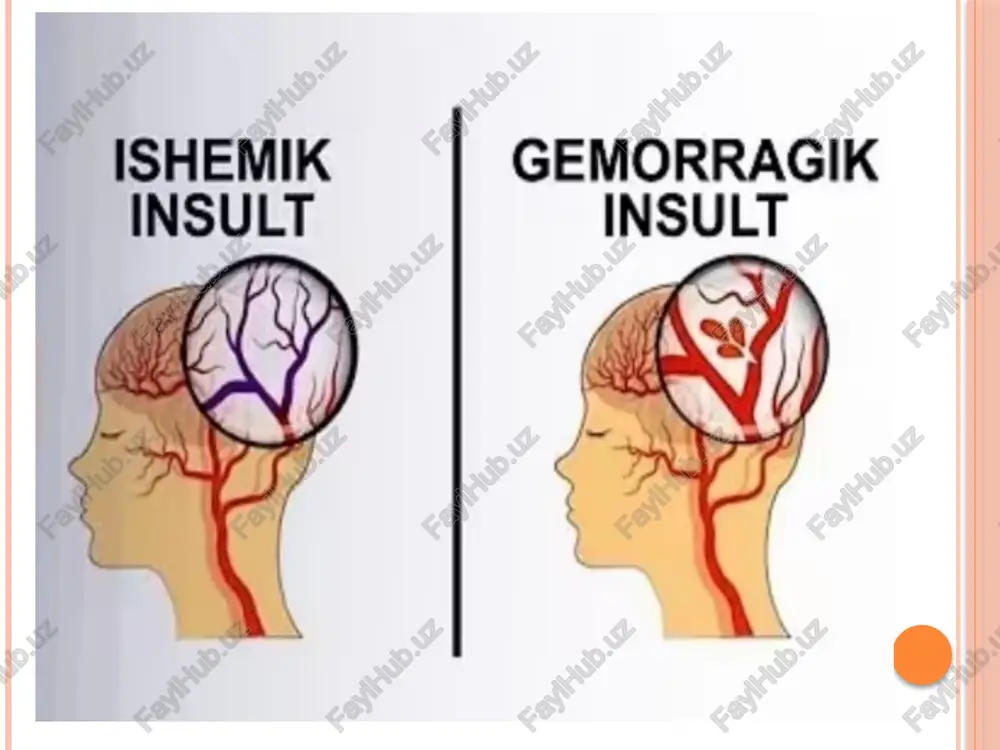 i; daqiqada 25 tomchidan kalsiy xlor yoki kalsiy xlor yoki t/ i yoki kuniga 4—6 kalsiy glukonat kalsiy glukonat marta 3—5 kun m/ o 10% 5 — 10,0 ml 10% 5 — 10,0 ml yoki t/ i. keyinchalik t/ i aminokapron t/ i aminokapron qon ivishi tekshirilib kislota 5%—100,0 kislota 5%—100,0 geparinni 5 ming ml tomchilab t/ i ml tomchilab t/ i òbdan t/ i yoki m/ o har 4—6 soatda har 4—6 soatda har 6 soat daqdi. qaytarish kerak. qaytarish kerak. qon, plazma, qon, plazma, disinon 2,0 ml yoki disinon 2,0 ml yoki vikasol 1,0 ml m/ o vikasol 1,0 ml m/ o gemorragik insult gemorragik insult e’tiboringiz uchun raxmat! image2.png image3.png image4.png image5.png image6.png image7.png image8.png image9.png /docprops/thumbnail.jpeg