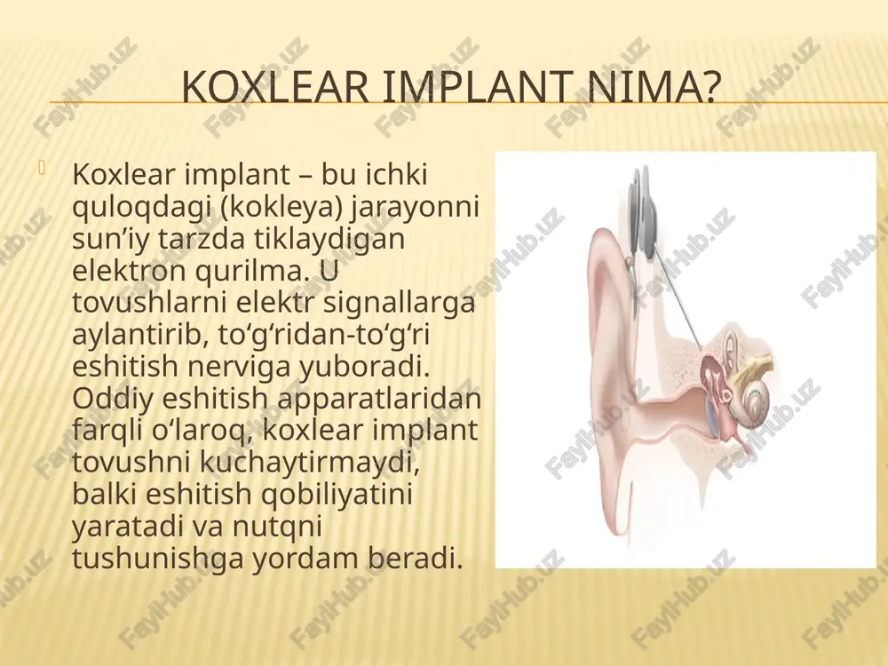 koxlear implant haqidamalumot - Page 4