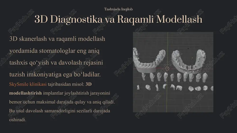 zamonaviy stomatologik dastaklar - Page 4