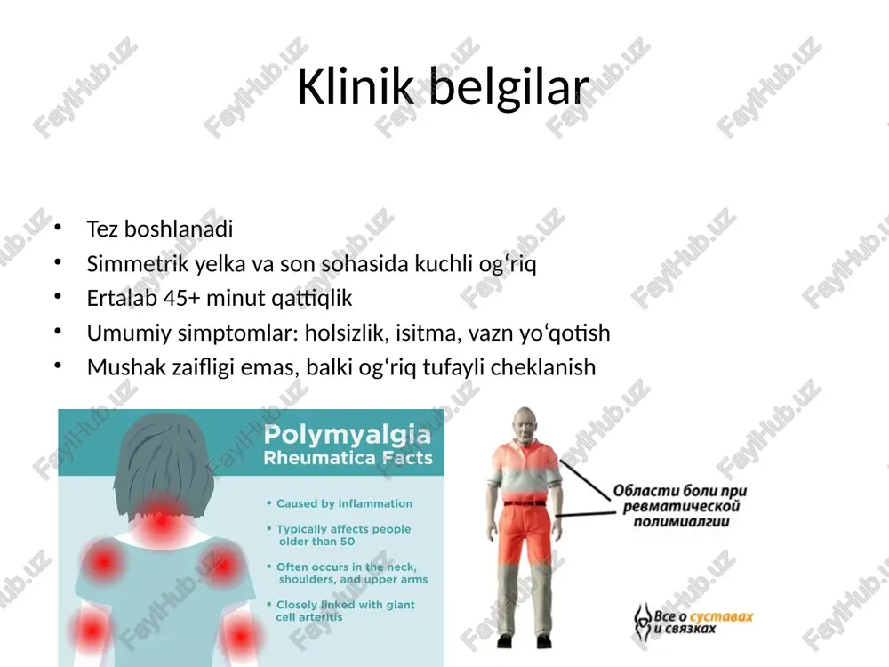 revmatik polimialgiya - Page 4