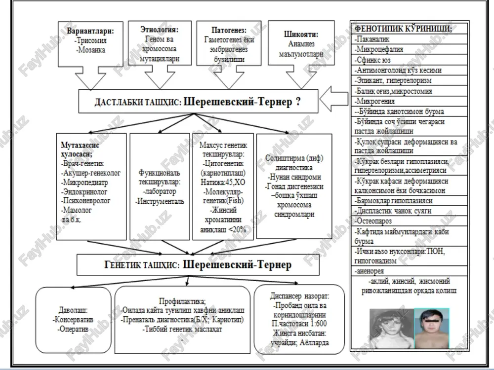shereshevskiy – terner kasalligi - Page 4
