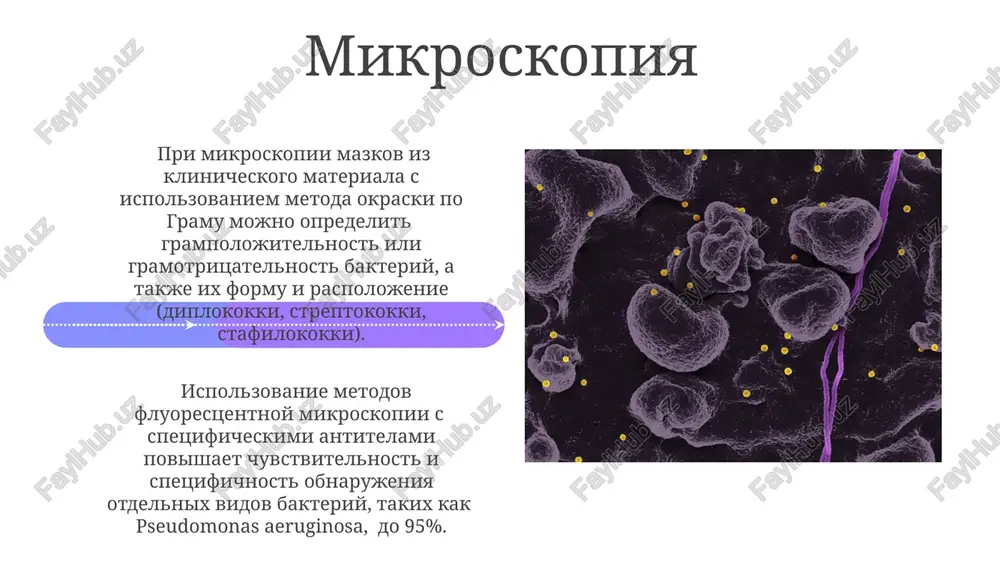 i chasto vizivayut infektsii v otdeleniyax intensivnoy terapii, dostigaya 20% sluchaev. grampolojitelnie kokki, takie kak staphylococcus aureus (vklyuchaya metitsillin-rezistentnie shtammi - mrsa) i enterococcus spp., sostavlyayut znachitelnuyu dolyu (do 30%) ot vsex vozbuditeley nozokomialnix infektsiy. protozoynie infektsii naibolee chastim vozbuditelem protozoynix nozokomialnix infektsiy yavlyaetsya cryptosporidium parvum, vizivayushiy diareyu, osobenno u immunokomprometirovannix patsientov; ego diagnostika vklyuchaet metodi mikroskopii i ptsr. diagnostika toksoplazmoza, vizvannogo toxoplasma gondii, chasto zatrudnena iz-za nizkoy chuvstvitelnosti traditsionnix metodov; ptsr i serologicheskie issledovaniya yavlyayutsya bolee effektivnimi metodami, osobenno s uchetom dlitelnogo inkubatsionnogo perioda (do 21 dnya). metodi laboratornoy diagnostiki serologicheskie metodi, vklyuchaya ifa i rnga, opredelyayut nalichie antitel k vozbuditelyam, chto vajno dlya retrospektivnoy diagnostiki, osobenno pri titrax antitel >1:160. mikrobiologicheskie metodi, takie kak posev na pitatelnie sredi (bolee 100 tipov) i identifikatsiya s pomoshyu maldi-tof ms, pozvolyayut opredelit vozbuditelya s visokoy tochnostyu za 24-72 chasa. spasibo za vnimanie @taqdimot_robot image4.jpg image5.jpg image6.jpg image7.jpg image8.jpg image9.jpg image10.jpg image11.jpg …