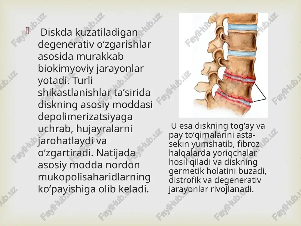 osteoxondroz - Page 4