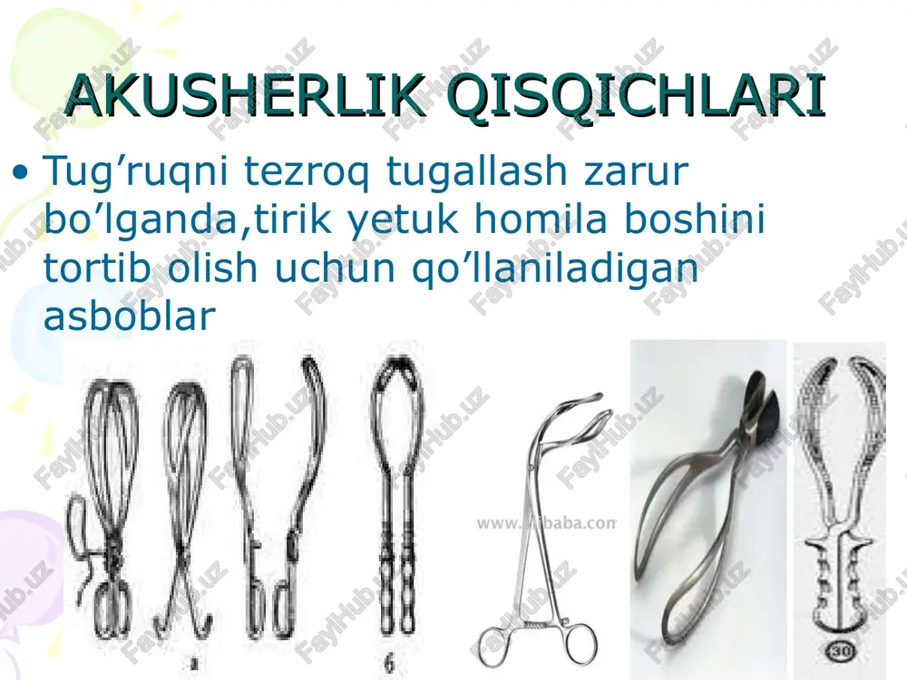 tkazish sharoitlari. tirik, etilgan xomila operatsiya utkazish vaktini tanlash etuk mutaxassis bulishi onaning roziligi. operatsiyadan oldingi tayyorgarlik qorin bo’shlig’ini ochib kirish boshning bachadondan chiqarilishi platsentaning chiqarilishi bachadon bo’shligi qo’l bilan tozalanadi bachadon qavatlarini tikish qorin bo’shlig’iga kiritishga tayyorlanadi bachadon qorin boshligiga kiritiladi peritonizatsiya terini donati bo’yicha tikish kesar-kesish operatsiyasining ayol organizmidagi ta'siri bepushtlik xomilani kutara olmaslik xayz tsikli buzilishi xomila tushishi xavfi yuldosh etishmovchilik bachadon chandigi yod jismni qolib ketishi infeksiya tushishi choklar nosozligi imun tanqisligi peritonit sepsis chandiqlar video-akusherlik qisqichlari kesarevo sechenie video-vacuum at c-section (high res).rus. etibor uchun tashakkur !