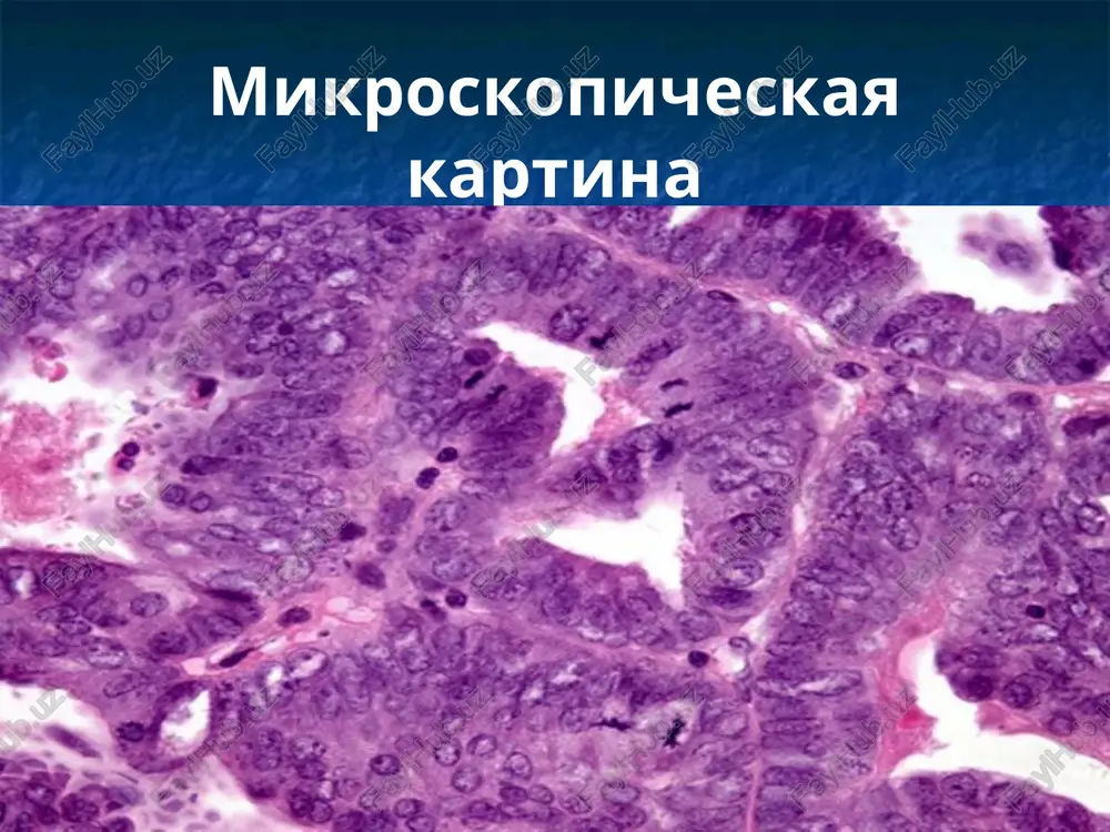 sovremennie metodi diagnostiki i lechenie onkologicheskie bolnix - Page 4