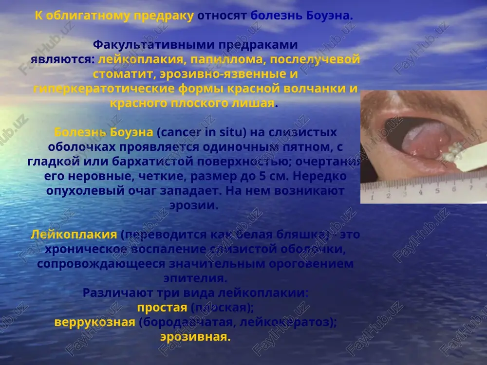 azirovaniya. ix takje mojet bespokoit nalichie pripuxlosti ili yazvi vo rtu, rasshativanie i vipadenie zubov, krovotochivost slizistoy obolochki polosti rta. pozdnee prisoedinyayutsya jalobi na zatrudnennoe otkrivanie rta, na trudnost ili nevozmojnost priema pishi, na nepriyatniy zapax izo rta i obilie slyuni, na poyavlenie pripuxlosti shei i litsa, poxudanie diagnostika pri osmotre i palpatsii slizistoy polosti rta obnarujivaetsya izmenenniy uchastok. on otlichaetsya ot ostalnoy slizistoy obolochki vneshnim vidom i plotnostyu. po suti, mi vidim chast tkani opuxoli, kotoraya prinimaet razlichnie formi i ochertaniya, a ostalnaya chast opuxolevoy tkani raspolojena pod slizistoy obolochkoy. eto mojet bit plotnaya bezboleznennaya blyashka serogo ili rozovogo tsveta, s melkobugristoy poverxnostyu. ona nemnogo vistupaet nad urovnem slizistoy i imeet chetkie granitsi. mojno uvidet plotniy, bezboleznenniy, sero-rozovogo tsveta uzel, s chetkimi granitsami. on znachitelno vistupaet nad urovnem neizmenennoy slizistoy. poverxnost ego sredne- ili krupnobugristaya. rakoviy uzel imeet shirokoe i plotnoe osnovanie. mojno nablyudat yazvu nepravilnoy formi, s bugristim …