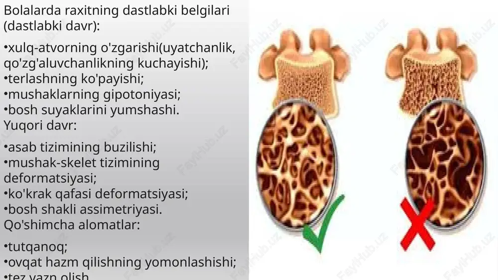 raxit va asta peroz davolash usullari - Page 4