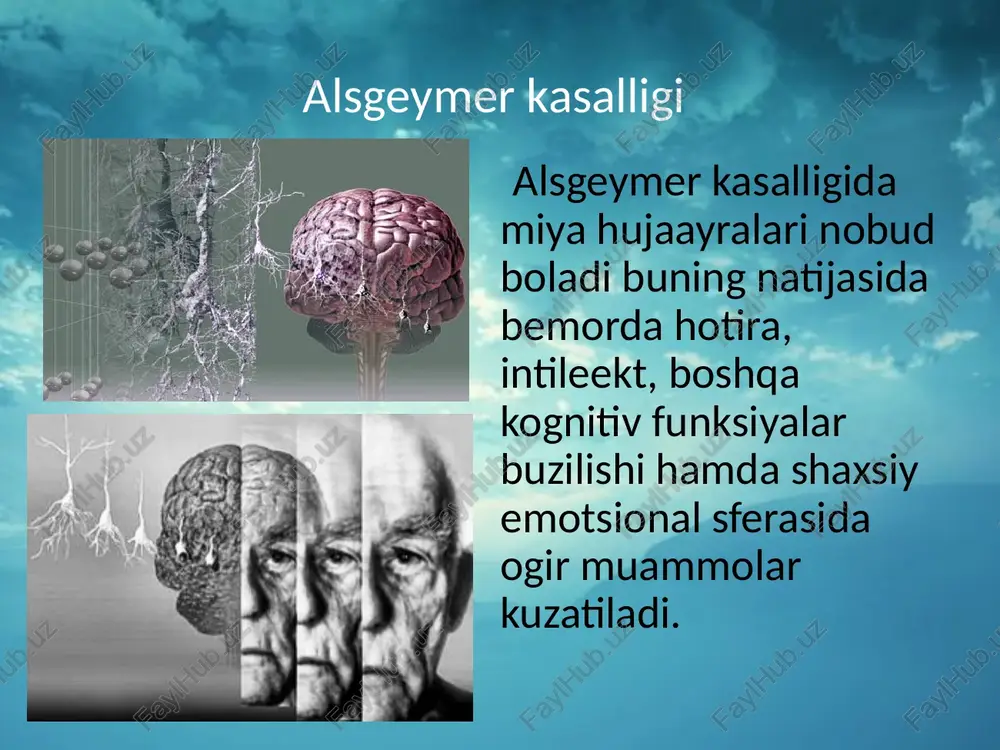 nsentratsiyasi oshadi. bu dori aqliy qobiliyatni yaxshilaydi. shunga o`xshash dorilar ekselon va razodin. ulaar tasir qilishi ham asetilholin miqdorini oshiradi. o`rta va og`ir darajalarida namenda qo`llaniladi. yana kogneks ham ishlatiladi. u ham asetilholin miqdorini oshiradi. profilaktika intelektual aktivlik shaxmat o`ynash, ko`proq suxbatlashish alsgeymer rivojlanishini kamaytiradi. meva va sabzavotlar, non, bug`doy maxsulotlari, olivkoviy maslo, baliq, qizil vino, alsgeymer kasalligi rivojlanishini kamaytiradi. intelektual o`yinlar kitob o`qish, stol o`inlari, krasvordlar yechish, musia asboblarida mashlar qilish, har doim suxbatlashish alsgeymer rivojlanishini kamaytiradi yoki yengillashtiradi. birdan ortiq tilni bilish ham alsgeymer kasalligini kech rivojlanishiga tasir qiladi. e`tiboringiz uchun raxmat. image2.jpeg image3.jpeg image4.jpeg image5.jpeg image6.jpeg image7.jpeg image8.jpeg image9.jpeg image10.jpeg image11.jpeg image12.jpeg image13.jpeg image14.jpeg image15.jpeg image16.jpeg image17.jpeg image18.jpeg image19.jpeg image20.jpeg image21.jpeg image22.jpeg image23.png image24.jpeg image25.jpeg image26.jpeg image27.jpeg image28.jpeg image29.jpeg image30.jpeg image31.jpeg image32.jpeg image33.jpeg image34.jpeg image35.jpeg image36.jpeg image37.jpeg image38.jpeg image39.jpeg image40.gif image41.jpeg image42.jpeg image43.jpeg image44.gif image45.jpeg image46.jpeg image47.jpeg image48.jpeg image49.jpeg image50.jpeg image51.jpeg image52.jpeg image53.jpeg image54.jpeg image55.jpeg image56.jpeg image57.jpeg …