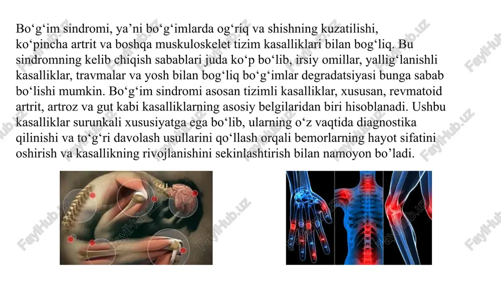 ib kelishi mumkin, shuning uchun revmatologga murojaat qilish zarur. 16 podagraning sabablari: siydik kislotasining koʻpayishi: organizmdagi siydik kislotasi darajasining oshishi podagraning asosiy sababi hisoblanadi. kristallarning toʻplanishi: siydik kislotasi kristallari boʻgʻimlarda toʻplanib, yalligʻlanishga olib keladi. 17 podagra belgilari: oʻtkir hujumlar: boʻgʻimlarda (koʻpincha bosh barmogʻida) keskin ogʻriq, shish, qizarish va mahalliy haroratning koʻtarilishi kuzatiladi. yalligʻlanish: taʼsirlangan boʻgʻim atrofida yalligʻlanish jarayoni rivojlanadi. davolash va oldini olish: dori-darmonlar: oʻtkir hujumlar paytida ogʻriqni kamaytirish uchun dori-darmonlar buyuriladi. parhez oʻzgarishlari: baʼzi oziq-ovqat mahsulotlaridan voz kechish orqali xavfni kamaytirish mumkin. uzoq muddatli davolash: tez-tez xurujlar boʻlsa yoki buyrak toshlari kabi asoratlar boʻlsa, qondagi siydik kislotasi darajasini pasaytirish uchun uzoq muddatli dori-darmonlar buyurilishi mumkin. shifokorga murojaat qilish: podagradan shubhalansangiz, imkon qadar tezroq revmatologga murojaat qilish muhimdir, revmatik artrit – autoimmun jarayon, simmetrik shikastlanish va deformatsiya. osteoartroz – degenerativ kasallik, asosan katta bo‘g‘imlarda. podagra – metabolik buzilish, siydik kislotasi kristallari, to‘satdan og‘riq. yuqumli artrit – mikroblar sababli, og‘ir umumiy …