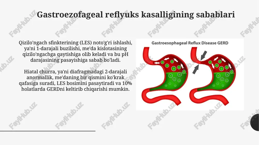 r, kofe, shokolad va yog'li mahsulotlardan saqlanishi kerak. oldini olish choralari ovqatdan so'ng kamida 2-3 soat davomida yotishdan saqlaning, bu esa qizilo'ngachga kislota qaytishini kamaytirishga yordam beradi va simptomlarni nazorat qiladi. kichik, tez-tez ovqatlanishni tanlang, chunki katta ovqatlar oshqozonni haddan tashqari to'ldiradi va pastki qizilo'ngach sfinkteriga bosimni oshiradi. xulosa xulosa qilib aytganda, gastroezofageal reflyuks kasalligi (gerd) simptomlarini kamaytirish uchun hayot tarzini o'zgartirish, masalan, ovqatlanish tartibini sozlash va vaznni nazorat qilish juda muhimdir. farmakologik davolash, jumladan, proton nasos inhibitorlari (ppi) va h2-retseptorlari blokerlari, kislota ishlab chiqarishni kamaytirish va shifo jarayonini tezlashtirishda samarali bo'lishi mumkin, ammo nojo'ya ta'sirlarni hisobga olish kerak. e'tiboringiz uchun rahmat image1.png image2.jpg image3.jpg image4.jpg image5.jpg image6.jpg image7.jpg image8.jpg image9.jpg image10.jpg image11.jpg image12.jpg image13.jpg image14.jpg image15.jpg image16.jpg image17.jpg image18.jpg