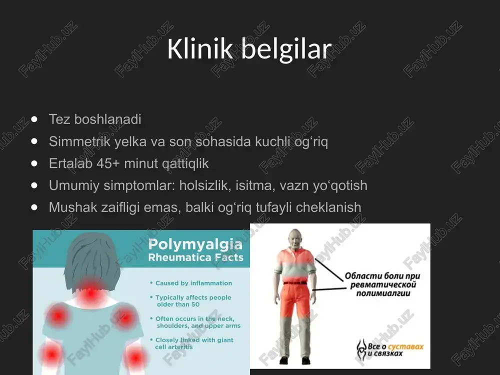 revmatik polimialgiya - Page 4