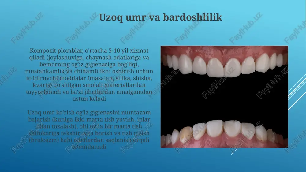 it plombasi (rezin asosidagi material yordamida), tishdagi chuqurcha (2-5 mm gacha) larni to'ldirish uchun qo'llaniladi e'tiboringiz uchun rahmat @taqdimot_robot image1.jpg image2.jpg image3.jpg image4.jpg image5.jpg image6.jpg image7.jpg image8.jpg image9.jpg image10.jpg image11.jpg image12.jpg image13.jpg