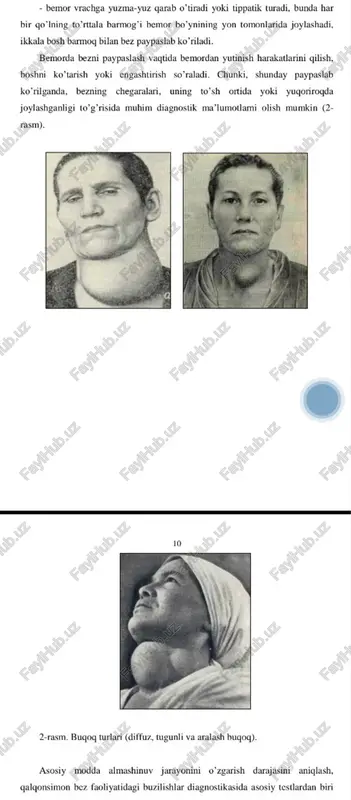 qalqonsimon bez kasalliklari - Page 4