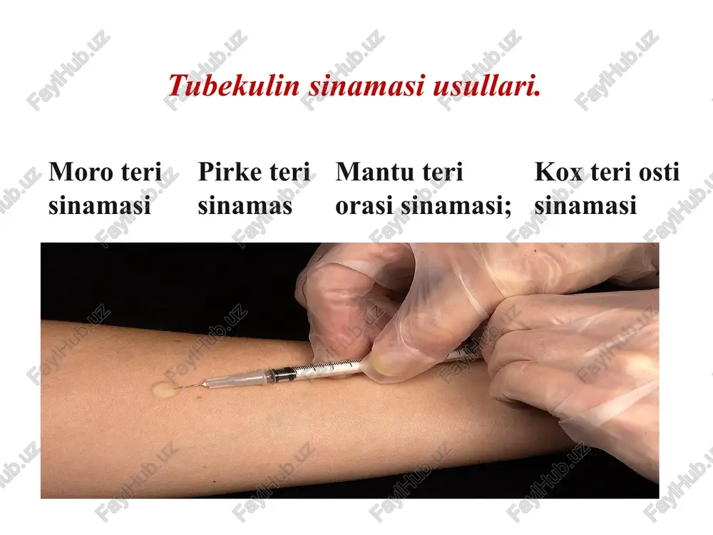 siga kateter orqali yuboriladi. bunda kontrast eritma yuqori kavak venasi yoki yurakning ong kameralariga boradi. rentgen tasvirlar maxsus angiografik apparatda seriyali tarzda olinadi. selektiv angiopulmonografiya kichik qon aylanish doirasidagi bosim va qon tarkibidagi gaz tekshiruvini qayd etish bilan birga olib boriladi. spirografiya vaqt davomida o'pka hajmidagi o'zgarishlarni aks ettiradigan nafas harakatlarini grafik qayd qilishdan iborat boladi. spirografiya jarayonida traxeobronxial otkazuvchanlikni baholash uchun votchala-tiffno sinamasini ham qollash mumkin. u bemor maksimal nafas olgandan song jadal nafas chiqargandagi birinchi soniyada chiqqan havo hajmini aniqlaydi (meyorda 70% dan kam bolmaydi). image15.png image3.jpeg image4.jpeg image5.jpeg image6.jpeg image7.jpeg image8.jpeg image9.jpeg image10.png image11.png image13.jpeg image14.jpeg