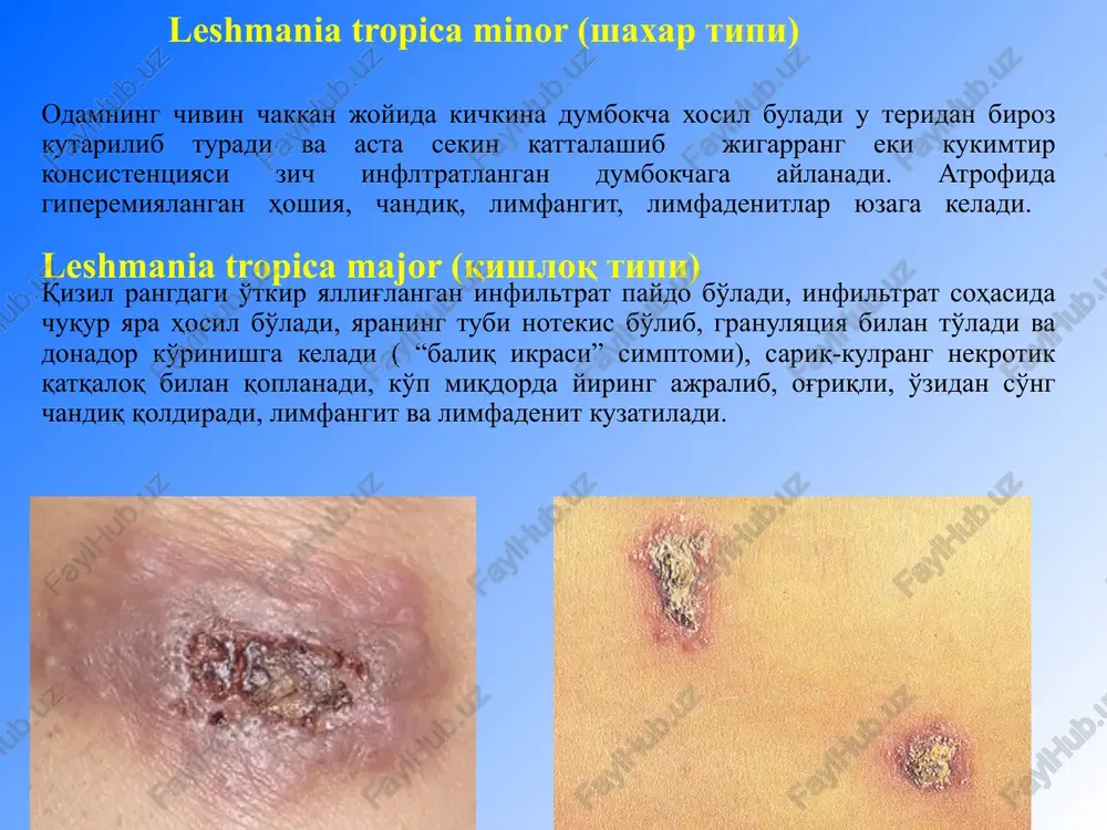 ermatozovlardan keyin paydo bo'ladi ikkilamchi gipopigmentatsiya davolash va tekshiruv usullari tor mutaxasislar tomonidan tekshiruv utkazish,xamrox kasalliklarni aniklash vitaminlar guruxidan v, s, nikotin kislota sedativ preparatlar eubiotiklar antigistamin preparatlar fermentlar pufo terapiya e'tiboringiz uchun raxmat image1.jpg image2.jpg image3.png image4.jpg image5.jpg image6.jpg image7.jpg image8.jpg image9.jpg image10.jpg image11.jpg image12.png image13.jpg image14.png image15.png image16.jpg image17.jpg image18.jpg image19.png image20.jpg image21.jpg image22.png image23.png image24.jpg image25.jpg image26.png