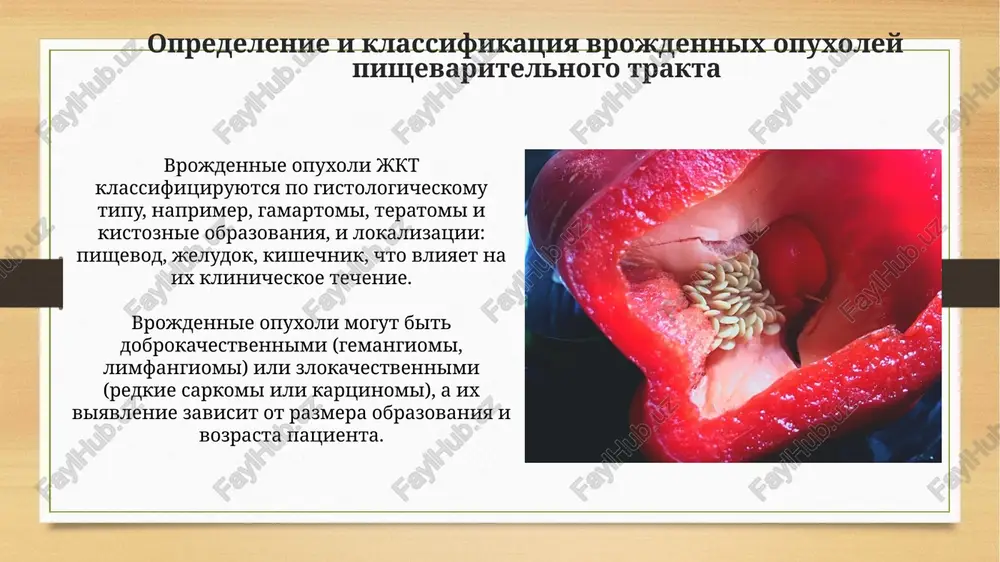 bifurkatsiya pishevaritelnogo trakta - Page 4