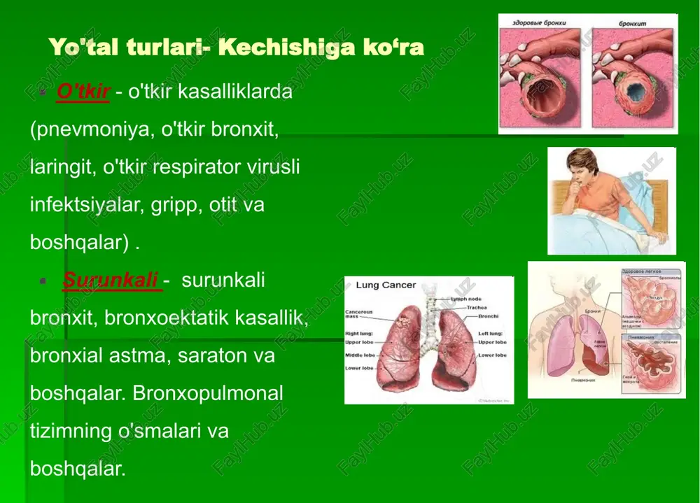 astma.) majburiy xolat kuruk plevrit bronxial astma xuriji ko'krak qafasini kuzdan kechirish ko'krak qafasinining shakli simmetrikligi nafas aktida qatnashishi deformtsiyalar ko'krak qafasini paypaslash tekshiruv ma'lumotlarini to'ldirishga va og'riq joylarini aniqlashga, uning qarshiligini aniqlashga va ovoz titrashini (fremitus pektoralis) o'rganishga imkon beradi. ko'krak qafasidagi ko'plab jarrohlik kasalliklarining diagnostik imkoniyatlarini kengaytiradi (ko'krak qafasi abstsessi, qovurg'a sinishi, qovurg'alardagi yallig'lanish va o'sma jarayonlarida siqilish). ko'krak qafasini paypaslash ogriqni aniqlash ko'krak qafasining elastikligi va rezistentligini aniqlash ovoz dirillashini aniqlash palpatsiya texnikasi palpatsiya ikkala qo'l bilan ham amalga oshiriladi, barmoqlarning palmar yuzalari ko'krakning chap va o'ng simmetrik qismlarida joylashtiriladi. qo'llarning bu pozitsiyasi bilan nafas olish ekskursiyasi va nafas olish paytida ko'krak qafasining orqada qolishi aniqlanadi. palpatsiya og'riqli joylarni aniqlash imkonini beradi (interkostal mushaklar, nerv zararlanishi, qovurg'alar shikastlanishii). palpatsiya texnikasi ba'zi hollarda palpatsida plevra ishqalanish shovqini seilzadi. palpatsiya paytida plevra bo'shlig'ida ko'p miqdordagi suyuqlik yoki havo to'planishi bilan qovurgalararo mushaklarning taranglanishi aniqlanadi. ko'krak qafasi qarshiligi va elastikligi …
