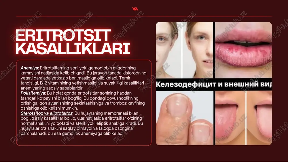 eritrotsitlar gemaglabin va uning turlari - Page 4