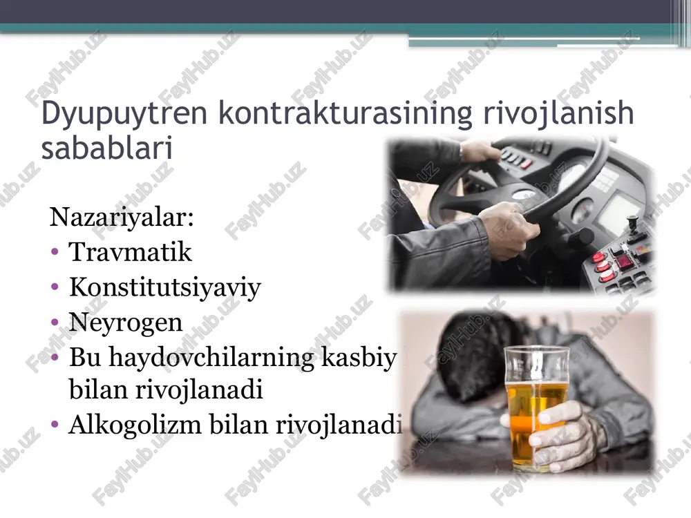dyupyuitren kontrakturasi - Page 4