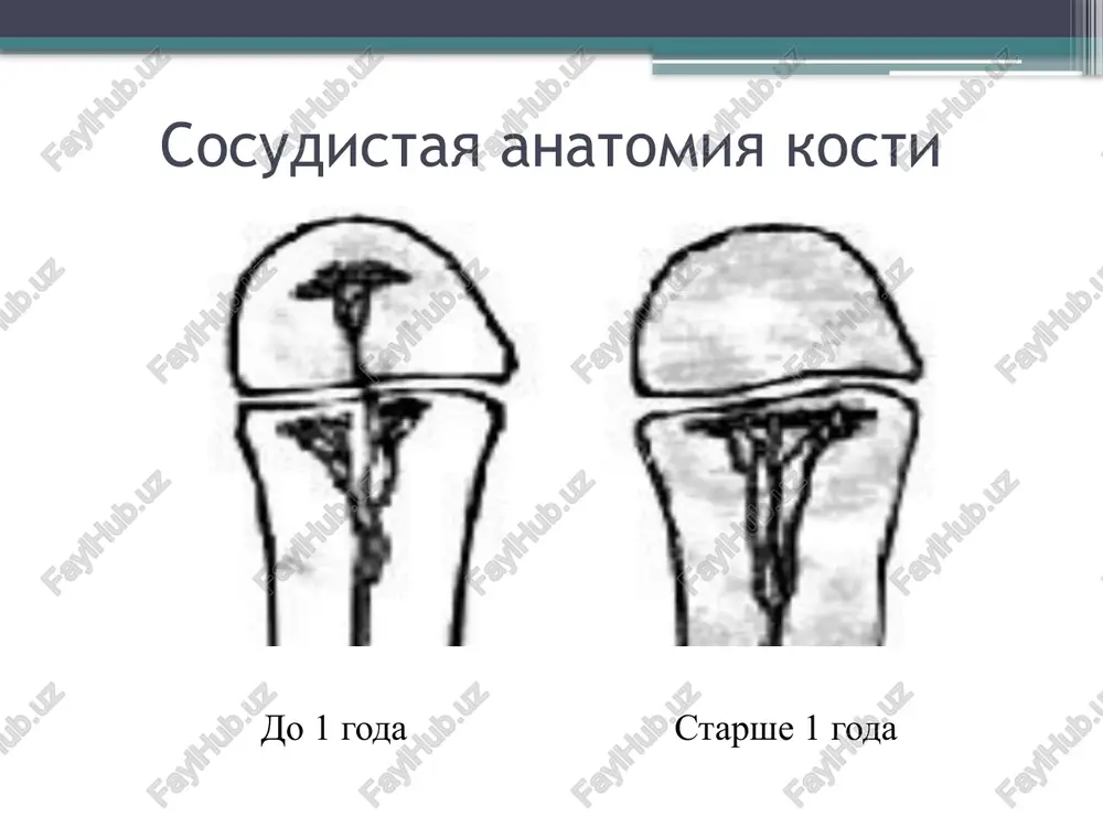 truktivnie ochagi i pyatnistiy osteoporoz differentsialnaya diagnostika travmoy; kostno-sustavnoy formoy tuberkulyoza; ostroy revmaticheskoy lixoradkoy; nagnoivsheysya gematomoy; neosteomieliticheskoy flegmonoy, abstsessom, limfadenitom; kostnimi opuxolyami ( osteogennaya sarkoma, sarkoma yuinga); lechenie po t.p. krasnobaevu: - vliyanie na makroorganizm; - vliyanie na mikroorganizm; - vliyanie na ochag vospaleniya. vliyanie na makroorganizm korrektsiya narusheniy gemodinamiki; korrektsiya narusheniy veb, kshr; dezintoksikatsionnaya terapiya ( infuzionnaya terapiya, plazmaferez, gemodializ); immunoterapiya ( antistafilokkovaya plazma, immunostimulyatori i dr.); desensibiliziruyushaya; oksigenoterapiya; vliyanie na mikroorganizm 1.ratsionalnaya antibiotikoterapiya s uchetom mikroflori i chuvstvitelnosti eyo k antibiotikam; polusinteticheskie penitsillini (oksatsilin); tsefalosporini ( tseporin, tsefaleksin, tsefepim, tseftriakson, tsefotaksim); rifampitsin 8-10 mg/kg; fuzidin 40-80 mg/kg; linkomitsin 30-60 mg/kg; amikatsin 7-10 mg/kg; metronidazol 15-20 mg/kg 2. antiseptiki: dioksidin; xlorofillipt; yodopiron; linkomitsin na 0,5 % novokaine; kanamitsin. vnutriochagovoe drenirovanie po metodu k.p. aleksyuka v osteomieliticheskiy ochag vvodyatsya postoyannie igli spetsialnoy konstruktsii. eto pozvolyaet provodit berejnoe drenirovanie vnutrikostnogo ochaga, a takje obespechivaet vvedenie neposredstvenno v ochag vospaleniya antibiotiki, antiseptiki, …