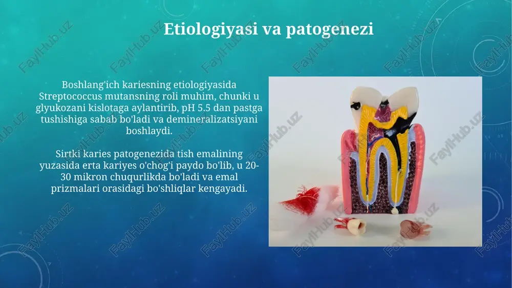 karies bosqichlari - Page 4