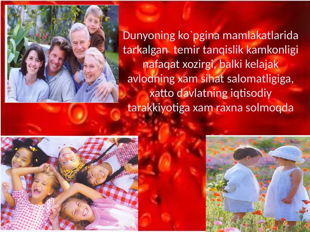 niy faollikning pasayishi xotira zaiflashib, ish kobiliyati pasayadi organizm immun xolati pasayib, kasalliklarga beruluvchanlik oshadi xomiladorlikning kechishi ogirlashadi kamqon va nosog`lom bola tugiladi o`spirin kizlarning balog`atga etishi kechikadi buqoq kasalligini kechishini kuchaytiradi anemiya nima uchun xavfli ? yurak xastaliklari kuchayadi temir tanqislik anemiyasi diagnostikasi umumiy qon taxlili (retikulotsit, eritrotsitlar morfologiyasi) zardobdagi temir mikdorini aniqlash temir tankislik anemiyasini davolash printsiplari tta fakat temir preparatlari bilan davolanadi imkoni boricha temir preparatlari per os berilishi zarur ( karshi kursatmalar bulmasa) temir preparatlari bilan birga uning surilishini yaxshilovchi preparatlar (askorbin kislota …..) berilishi zarur preparatning sutkalik dozasi gemoglobin kursatgichiga karab belgilanadi ( 80- 300 mg/ sut) davo effektivligini baxolash uchun 7-10 kunda retikulotsitlar mikdorini aniklash zarur temir preparatlari vrach tavsiyasiga kura temir preparatlarini iste'mol kilish bir kunlik temir preparati tax-minan 180-200 mg temir preparatlari temir preparatlari elementar temir mikdori sutkalik tavsiya tardiferon 80 mg 1-2 tabletka ginotardiferon 80 mg 1-2 tabletka ferrumlek (tab) 100 …