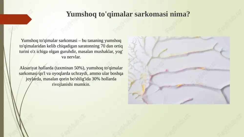 yumshoq toqima va suyak sarkomasi - Page 4