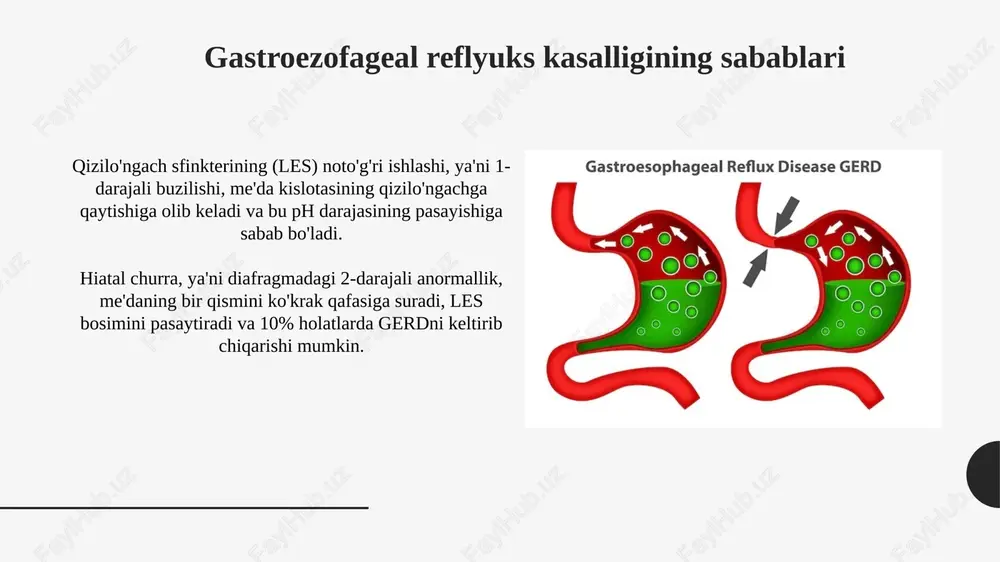 dalik ovqatlanish tartibiga rioya qilish kerak. bemor og'riqni kuchaytiradigan, masalan, gazlangan ichimliklar, achchiq ovqatlar, kofe, shokolad va yog'li mahsulotlardan saqlanishi kerak. oldini olish choralari ovqatdan so'ng kamida 2-3 soat davomida yotishdan saqlaning, bu esa qizilo'ngachga kislota qaytishini kamaytirishga yordam beradi va simptomlarni nazorat qiladi. kichik, tez-tez ovqatlanishni tanlang, chunki katta ovqatlar oshqozonni haddan tashqari to'ldiradi va pastki qizilo'ngach sfinkteriga bosimni oshiradi. xulosa xulosa qilib aytganda, gastroezofageal reflyuks kasalligi (gerd) simptomlarini kamaytirish uchun hayot tarzini o'zgartirish, masalan, ovqatlanish tartibini sozlash va vaznni nazorat qilish juda muhimdir. farmakologik davolash, jumladan, proton nasos inhibitorlari (ppi) va h2-retseptorlari blokerlari, kislota ishlab chiqarishni kamaytirish va shifo jarayonini tezlashtirishda samarali bo'lishi mumkin, ammo nojo'ya ta'sirlarni hisobga olish kerak. e'tiboringiz uchun rahmat slide 1 slide 2 slide 3 slide 4 slide 5 slide 6 slide 7 slide 8 slide 9 slide 10 slide 11 slide 12 slide 13 slide 14 slide 15 slide 16 slide 17 slide …