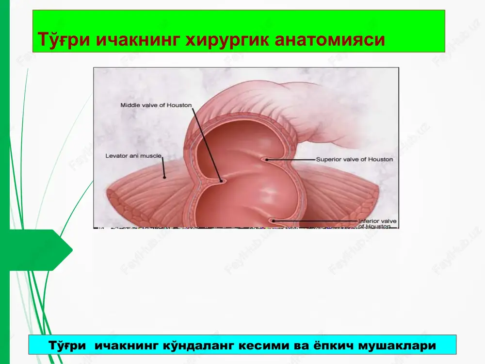 iqda xojatdan keyin qon tomchilari ajralib chiqishi kuzatiladi. orqa chiqaruv teshigi yorig'i ichki sfinkterotomiya. a) orka chikaruv teshigi yorigi va ichki sfinkterni kesish b) sxematik tasvir, v) shpatellar olingandan keyin jaroxat xolati orqa chiqaruv teshigi yorig'i maxalliy yoki endotraxeal narkoz ostida radial yunalishli urab oluvchi kesma bilan orka chikaruv teshigi gipertrofiyalangan yorigi va karunkula olib tashlananadi o'tkir paraproktit va paraproktal oqma paraproktit pararektal kletchatkaga infektsiya tushishi natijasida vujudga keladi. pararektal kletchatkaga mikroblar anal kriptalarga ochiladigan anal bezlardan tushadi. anal bezdagi yallig'lanish jarayoni natijasida uning yo'li bekiladi va sekret oqib chiqishi buziladi. o'tkir paraproktit paydo bo'lishiga moyillik tug'diradigan sabablar orasida to'g'ri ichak distal bo'limi va anal kanal shilliq pardasidagi mayda shikastlar birinchi o'rinda turadi. paraproktal abstsess va paraproktal oqma davrlari utkir paraproktit – abstsess surunkali paraproktit - paraproktal okma o'tkir paraproktit parakproktal abstsesslar: a) perianal, ), ishiorektal, s) pelviorektal, d) shillik osti o'tkir paraproktit klinikasi og'riq qizarish shish tana xarorati kutarilishi …