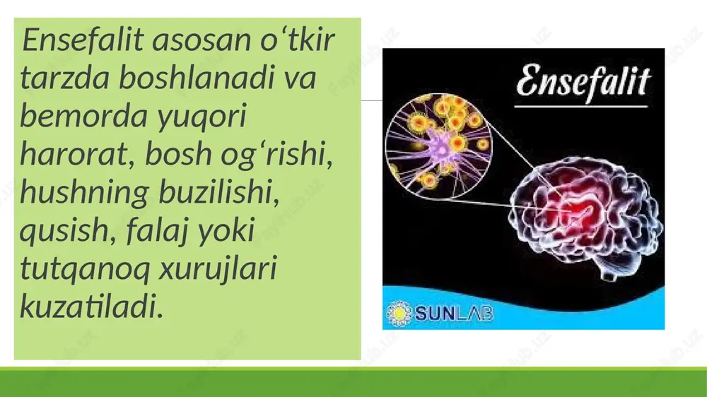 ensefalit kasalligining kelib chiqish sabablari va asoratlari - Page 4