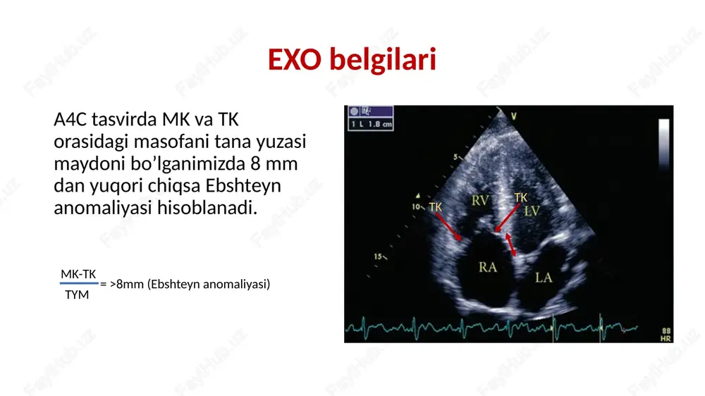 exokardiografiya - Page 4