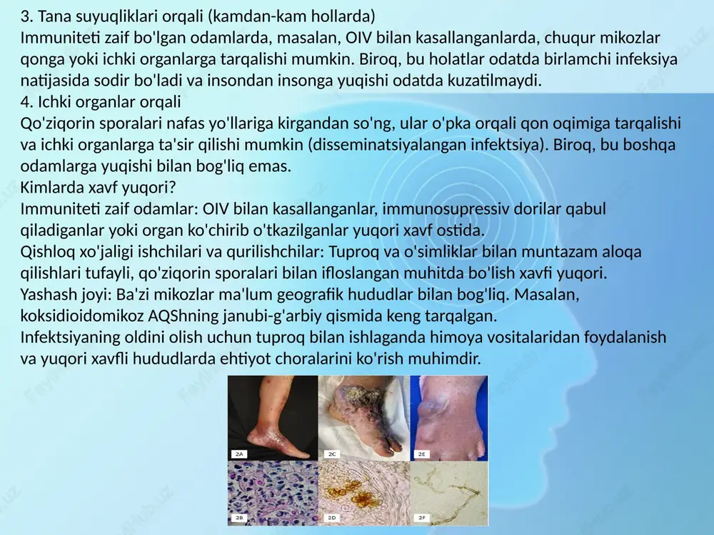 ohlik aralashuvi ba'zi hollarda qo'ziqorin infeksiyasi suyaklarda, bo'g'imlarda yoki terining chuqur qatlamlarida absess hosil qilsa, jarrohlik yo'li bilan infeksiyalangan to'qimalarni olib tashlash kerak bo'lishi mumkin. jarrohlik ba'zida og'ir organik zararlanish bo'lganida, masalan, o'pka yoki miya infeksiyalari paytida qo'llaniladi. 3. immunitetni qo'llab-quvvatlash immuniteti pasaygan bemorlarda (masalan, oiv bilan kasallanganlar yoki immunosupressiv dorilar qabul qilayotganlar) antifungal dorilar bilan bir qatorda asosiy kasallikni davolash ham muhimdir. immunitetni oshiruvchi terapiyalar (masalan, oiv davolash uchun antiretrovirus dorilar) infeksiyaga qarshi kurashda yordam beradi. davolashning davomiyligi chuqur mikozlarni davolash uzoq muddatli bo'lishi mumkin, ba'zi hollarda bir necha oydan bir yilgacha davom etadi. bu vaqt davomida bemorlar dori-darmonlarni qat'iy ravishda qabul qilishlari kerak, chunki davolashni erta to'xtatish infeksiyaning qaytalanishiga olib kelishi mumkin. davolash paytida muntazam tibbiy nazorat va laborator tekshiruvlar o'tkazilishi zarur bo'lib, bu dorilarning samaradorligi va yon ta'sirlarini kuzatish uchun muhimdir. e’tiboringiz uchun rahmat image2.jpeg image3.jpeg image4.jpeg image5.jpeg image6.jpeg image7.jpeg image8.jpeg image1.png