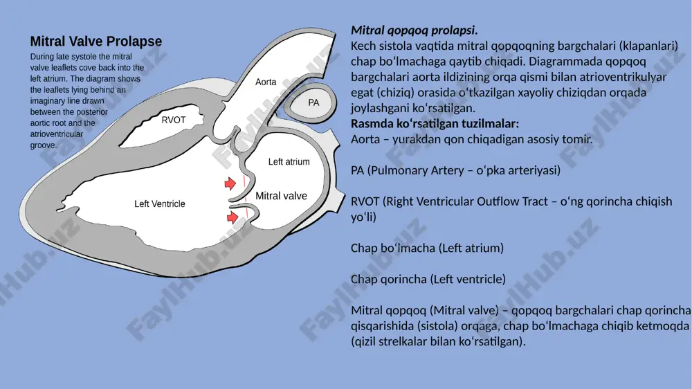 mitral klapan prolapsi - Page 5