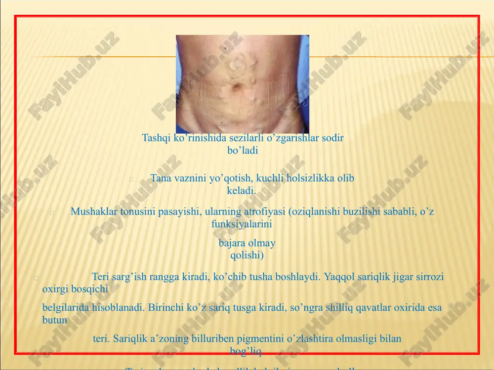 surunkali gepatit - Page 5