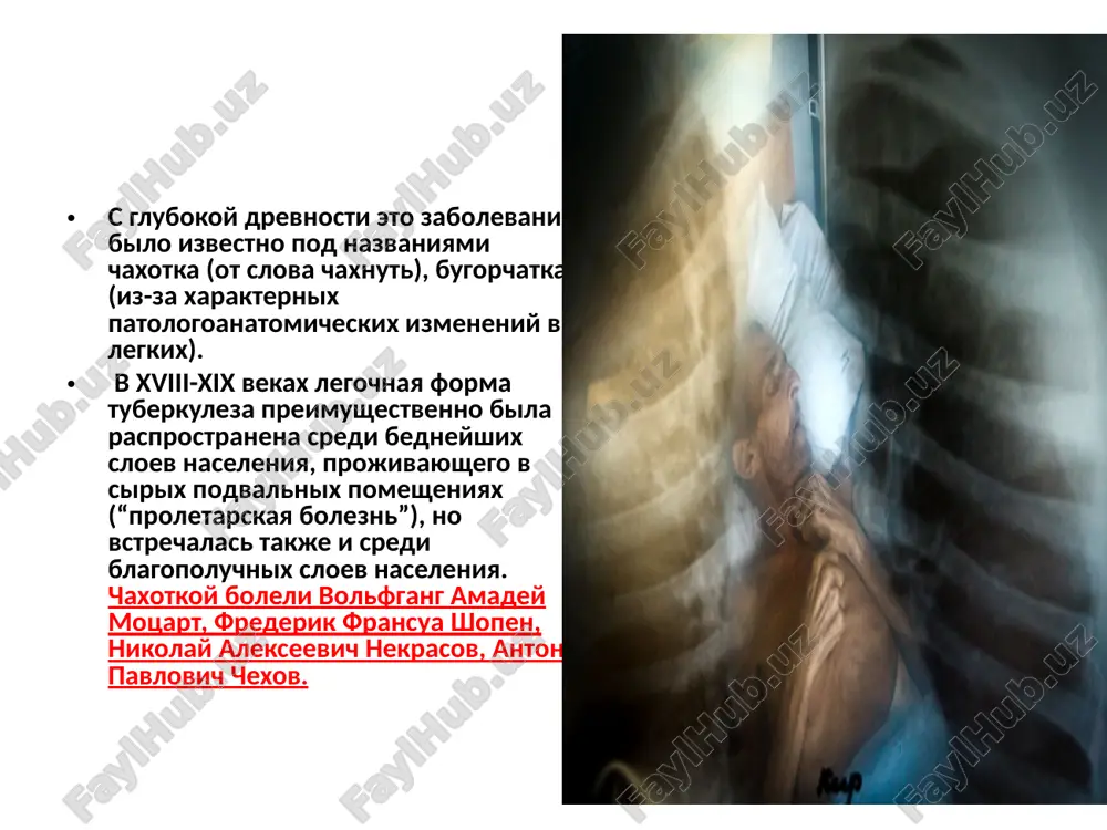 teriy tuberkuleza (batsilli kalmetta-gerena, bcg – bacilles calmetteguerin ili btsj). b- antibakterialniy period nachavshiysya s 50 –x godov 20ogo veka nachinaetsya era s izobreteniem z.vaksmanom- streptomitsina tuberkulez- izlechim!!! tuberkulez ne peradaetsya po nasledstvu! tuberkulez gennim putem ne peredaetsya; peredaetsya predraspolojennost (hla- kompleks soderjit lokusi otvetstvennie za razvitie tuberkuleza. esli eti lokusi povrejdeni, individ zaboleet tuberkulezom. esli izmeneniy lokusov net- stepen zabolevaniya tuberkulezom ne visoka) o merax po sovershenstvovaniyu sistemi okazaniya spetsializirovannoy ftiziatricheskoy i pulmonologicheskoy pomoshi: provedenie kompleksnoy profilaktiki tuberkuleza i nespetsificheskix zabolevaniy legkix na osnove vnedreniya innovatsionnix metodov, organizatsiyu diagnostiki i lecheniya latentnix form tuberkuleza, lits, podverjennix povishennomu risku zarajeniya tuberkulezom, a takje kontaktiruyushix s bolnimi lekarstvenno-ustoychivim tuberkulezom; v srok do 1 aprelya 2019 goda opredelit obosnovanniy kontingent lits, podverjennix povishennomu risku zarajeniya tuberkulezom, v tselyax provedeniya immunodiagnostiki; chislo tv infitsirovannix na zemnom share projivaet – 7 mlrd lyudey 2,3 mlrd iz nix infitsirovani mikobakteriyami, 10% iz nix zaboleyut razlichnmi …