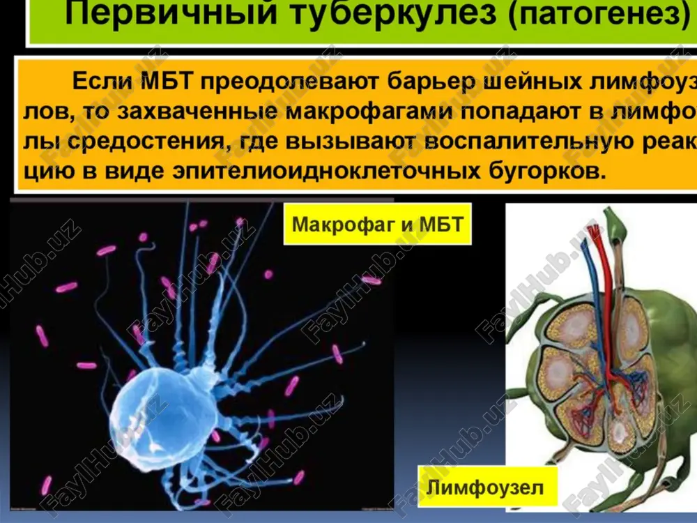 edeli poyavilsya suxoy kashel, intensivnost kotorogo usilivalas., besprichinno silno poteet, rezko poxudela. no i ranshe bila xudoy. rubets btsj-m- 2 mm. pri perkussii legkix ukorochenie sprava perkutorniy zvuk s korobochnim ottenkom, dixanie oslablennoe . na rentgenogramme ob'em pravogo legkogo umenshen v ob'eme , v verxne srednix otdelax legkix opredelyayutsya obshirnie zatemneniya shiroko svyazannie s kornyami., jivot uvelichen za schet pecheni i selezenki . v ekstrennom poryadke nalojen drenaj sprava. issledovana krov na vich, polojitelniy rezultat. diaskintest — 12 mm papula (cherez 72 chasa). image1.jpeg image2.png image3.jpeg image4.jpeg image5.jpeg image6.jpeg image7.jpeg image8.jpeg image9.jpeg image10.jpeg audio1.wav image11.jpeg image12.jpeg image13.jpeg image14.png image15.jpeg image16.jpeg image17.jpeg image18.jpeg image19.jpeg image20.png image21.png image22.jpeg image23.png image24.jpeg image25.jpeg image26.png image27.jpeg image28.png image29.jpeg image30.jpeg image31.png image32.jpeg image33.jpeg image34.jpeg image35.jpeg image36.jpeg image37.jpeg image38.jpeg image39.jpeg image40.jpeg image41.jpeg image42.jpeg image43.jpeg image44.png image45.jpeg image46.png image47.png image48.png image49.png image50.png image51.png image52.jpeg image53.jpeg image54.jpeg image55.jpeg image56.jpeg image57.jpeg image58.jpeg image59.jpeg image60.jpeg image61.jpeg image62.jpeg image63.png image64.jpeg image65.jpeg image66.jpeg …