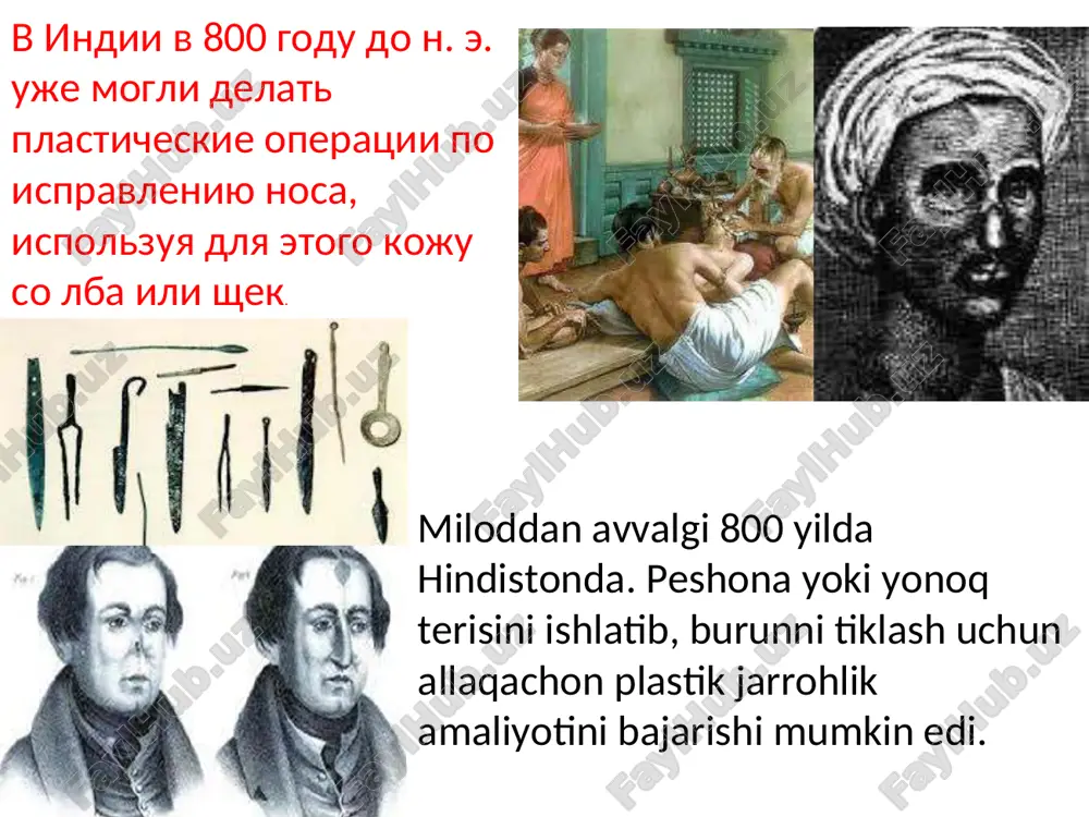 sababi bo'ldi. ular boshqa materiallarni sinab ko'rishni boshladilar, ammo barcha moddalar suyilib, bemorlar azob cheka boshladi. posle vtoroy mirovoy plasticheskaya xirurgiya sosredotochilas na operatsiyax po uvelicheniyu grudi i udaleniyu lishnego jira. voznikla moda na bolshoy byust. v 1950-x nachalis opiti s vvedeniem silikona, chtobi uvelichit razlichnie uchastki tela, no silikon ne fiksirovalsya na meste i stanovilsya prichinoy zarajeniya. stali probovat drugie materiali, odnako vse veshestva rastekalis i patsientki stradali. pervoy russkoy aktrisoy, reshivsheysya na podtyajku litsa, bila lyubov orlova — ona nachala delat sebe plasticheskie operatsii v 1946 godu, tayno viezjaya v parij (ey bilo togda 44 goda). sushestvuet versiya, chto operatsii ey oplachival charli chaplin. ochevidno, chto plastiku litsa uje togda delali neploxo: v 46 let orlova sigrala devushku-krasavitsu v «vesne», a v 70 — jenshinu slegka za 30 v kinolente «skvorets i lira». yuz terisini tortirishga qaror qilgan birinchi rus aktrisasi lyubov orlova bo’lib, u 1946- yilda yashirincha …