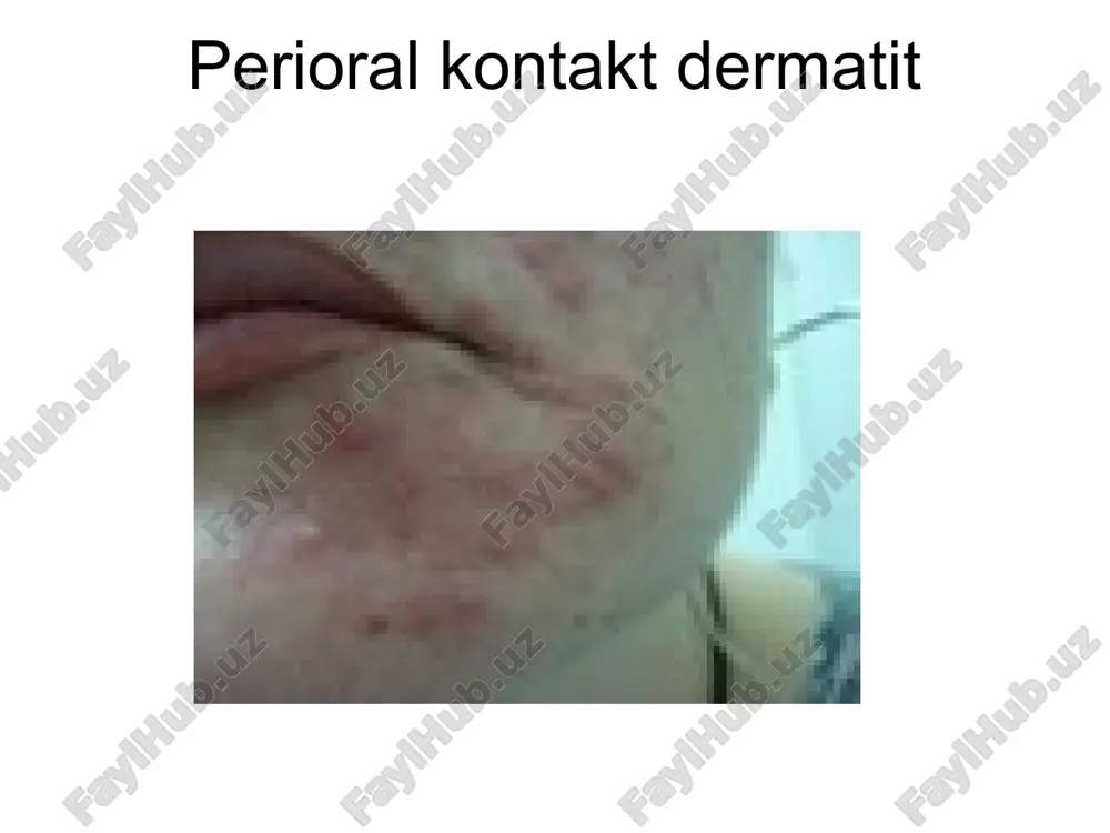 dermatitlar - Page 5
