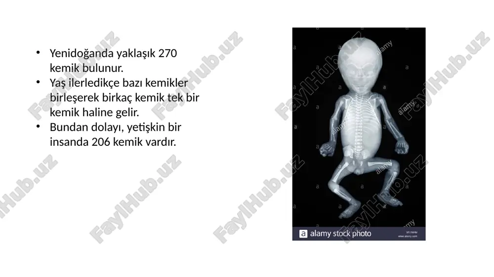 e bağlar stratum osteogenicum ( kambium tabakası= osteojen tabaka): osteoblastlar bulunur. gelişimini tamamlamış kemiklerde bulunmaz, osteoblastlar osteositlere dönüşür i̇htiyaç halinde tekrar osteoblastlara dönüşürler. www.liberaldictionary.com osteoblastlar : mezenşimal dokudan gelişir. ara maddeyi oluşturur ara madde içerisinde lacuna osseum denilen boşluklar içerisinde kalırlar osteositlere dönüşürler. osteositler : yassı hücreler olup çok sayıda uzantıları vardır. uzantıları, ara madde içinde yayılır, diğerleriyle birleşerek bir ağ mg. osteoklastlar : mezenşimal kaynaklı büyük hücrelerdir yıpranmış kemik dokusunu, çıkardığı enzimlerle tahrip ederek eritirler. principles of anatomy and physiology kemik dokusunda bulunan hücreler osteoblastlar (yapım rejenerasyon ) osteoklastlar (yıkım resorpsiyon ) osteosi̇tler (olgun kemik hücreleri) substantia spongioza kısa küçük kemikler ve uzun kemiklerin uçlarında bulunur. birbiriyle bağlantılı bölmelerden oluşur. bölmelerin içi kırmızı kemik iliği ile doludur. substantia compacta kollajen lifler, lameller şeklinde üst üste sıralanır havers sütunları ’nı oluşturur. 3-10 lamel ortasında havers kanalı vardır. osteon denilen havers sütunları, yan yana ve üst üste gelir osteon : lamellerin …