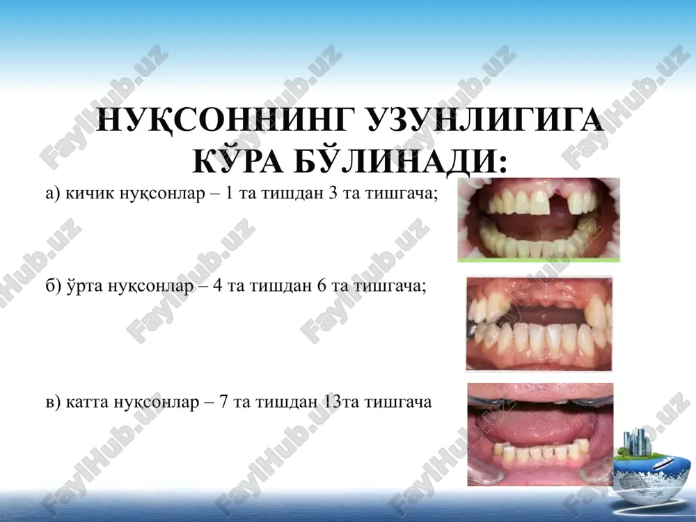 olinmaydigantishprotezlari - Page 5