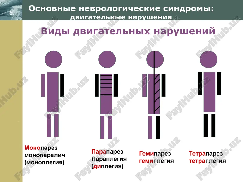eniya. profilaktika privivka ot virusa poliomielita www.themegallery.com company logo xromosomnie bolezni bolezn dauna prichina nalichie lishney xromosomi v nabore autosom. klinicheskie proyavleniya anomalii nervnoy sistemi: nedorazvitie mozga v tselom ili ego otdelnix chastey, mikrotsefaliya. chasti poroki serdtsa i drugix vnutrennix organov; endokrinnie narusheniya. narushenie intellekta. osobennost spetsificheskaya vneshnost bolnogo. rekomendatsii kompleksnaya lechebno-korrektsionnaya rabota, napravlennaya na sotsialnuyu adaptatsiyu detey. www.themegallery.com company logo vrojdennaya patologiya nervnoy sistemi gidrotsefaliya – mikrotsefaliya – progressiruyushee uvelichenie razmerov golovi vsledstvie izbitochnogo skopleniya spinnomozgovoy jidkosti v polosti cherepa. prichini vrojdennie poroki razvitiya likvornoy sistemi. klinicheskie priznaki progressiruyushee uvelichenie razmerov golovi. vsledstvie davleniya tserebrospinalnoy jidkosti na mozg razvivayutsya narusheniya dvigatelnoy sferi, snijenie zreniya i sluxa. stradayut vegetativnie funktsii. snijaetsya intellekt. vozmojni sluchai soxrannogo intellekta. gipertenzii v period dekompensatsii vizivayut silnie golovnie boli, toshnotu, golovokrujenie, narushenie koordinatsii dvijeniya. umenshenie razmerov cherepa i mozga. mojet vstrechatsya kak samostoyatelniy sindrom i kak simptom pri xromosomnix boleznyax. prichini vozdeystvie na razvivayushiysya mozg …
