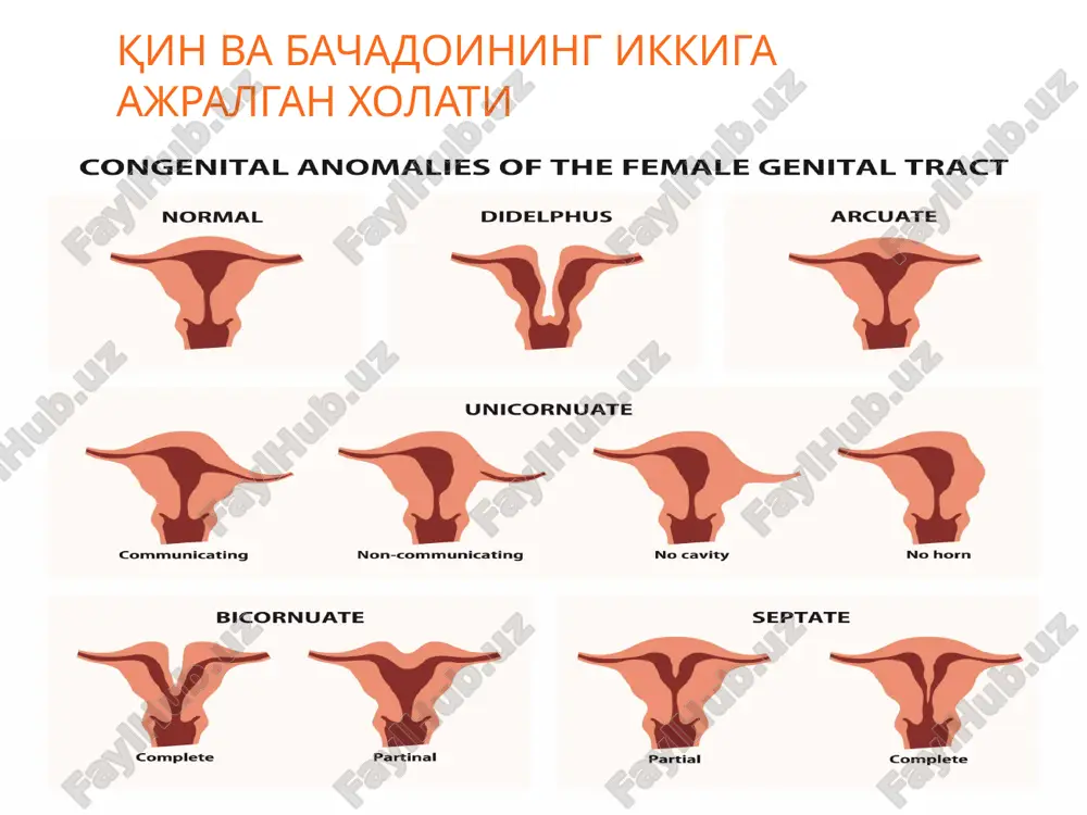 aqqiy etgan bo'ladi. sh unga qaramay, volf yo'li (urug' chiqadigan yo'l) va prostata bezining gomologi parauretral bez bo'ladi, bu ichki psevdogermafroditizm hisoblanadi.talqin qiladilar etiborinigiz uchun rahmat image3.png image4.jpg image5.jfif /docprops/thumbnail.jpeg
