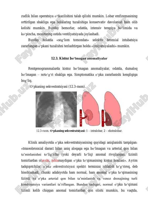 ilar, o‘pka sekvestratsiyasi spektri terminini ishlatish to‘g‘riroq, deb hisoblashadi, chunki adabiyotda ham normal, ham anomal o‘pka to‘qimasining tizimli va o‘pka arterial qon bilan ta’minlanish va venoz drenajining turli kombinatsiya variantlari ta’riflangan. bundan tashqari, normal o‘pka to‘qimasi tizimli kelib chiqqan anomal tomirlardan qon olishi mumkin, bu vaqtda, sekvestratsiyada aniqlanadiganga o‘xshash, anomal o‘pka to‘qimasi anomal qon ta’minlanishisiz ham bo‘lishi mumkin. zararlanish va bronxial kistlar kabi u bilan bog‘liq anomaliyalarning ta’riflangan kombintsiyalari turliligi va miqdori behisob. sekvestratsiyaning asosiy klinik ko‘rinishlari nafas olish tizimi bilan bog‘liq bo‘lsa-da, biroq aniqlangan simptomatika yurak tomonidan ham bo‘ladi, bu nafaqat faqat birlashgan tug‘ma cardinal nuqson, balki kuchli shuntlarning bo‘lishi tufayli bo‘ladi. keyinchalik ta’riflanishda sekvestratsiya anomal to‘qima normal o‘pka ichida joylashadigan intralobar va sekvestrlangan qism normal o‘pka qismidan ajratilgan va visseral plevra tashqarisida joylashgan ekstralobarlarga ajratiladi. shuningdek, psevdosekvestratsiya termini bilan aniqlanadigan nuqson ta’riflangan. intralobar sekvestratsiya, ko‘pincha pastki va orqa bazal segmentda, kichik bo‘laklarda aniqlanadi. rentgenologik ko‘rinishlari turlicha: soyalangan joydan …