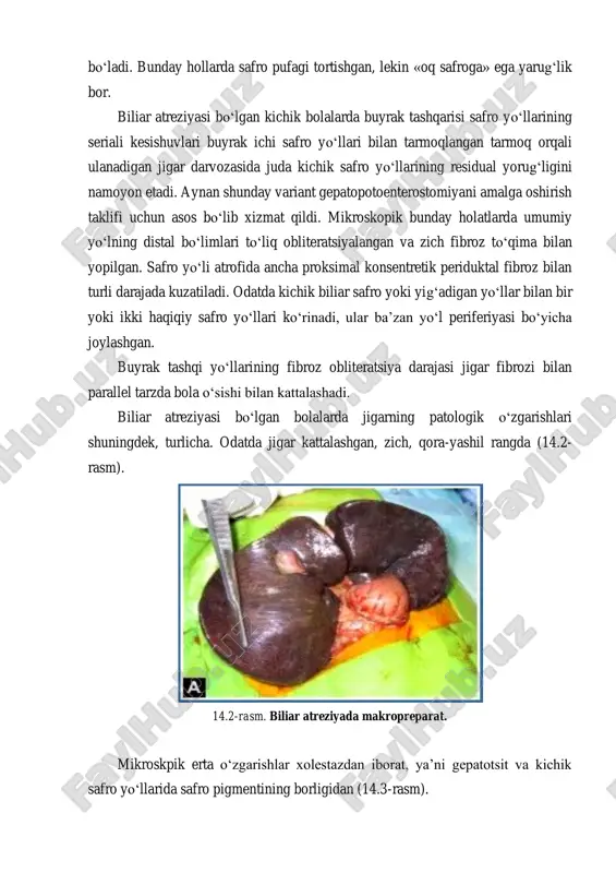 l yorug‘ligini namoyon etadi. aynan shunday variant gepatopotoenterostomiyani amalga oshirish taklifi uchun asos bo‘lib xizmat qildi. mikroskopik bunday holatlarda umumiy yo‘lning distal bo‘limlari to‘liq obliteratsiyalangan va zich fibroz to‘qima bilan yopilgan. safro yo‘li atrofida ancha proksimal konsentretik periduktal fibroz bilan turli darajada kuzatiladi. odatda kichik biliar safro yoki yig‘adigan yo‘llar bilan bir yoki ikki haqiqiy safro yo‘llari ko‘rinadi, ular ba’zan yo‘l periferiyasi bo‘yicha joylashgan. buyrak tashqi yo‘llarining fibroz obliteratsiya darajasi jigar fibrozi bilan parallel tarzda bola o‘sishi bilan kattalashadi. biliar atreziyasi bo‘lgan bolalarda jigarning patologik o‘zgarishlari shuningdek, turlicha. odatda jigar kattalashgan, zich, qora-yashil rangda (14.2- rasm). 14.2-rasm. biliar atreziyada makropreparat. mikroskpik erta o‘zgarishlar xolestazdan iborat, ya’ni gepatotsit va kichik safro yo‘llarida safro pigmentining borligidan (14.3-rasm). 14.3-rasm. biliar stazda mikroskopik kartina. kechroq buyrak tashqi xolestazining har qanday tipida buyrak ichi oqimlarining reaksiyasi safro yo‘llarining proliferatsiyasini chaqirgan holda, buyrak ichi biliar daraxtining kichik tarmoqchalari soni oshishiga olib keladi. aniq ifodalangan biliar atreziyada …