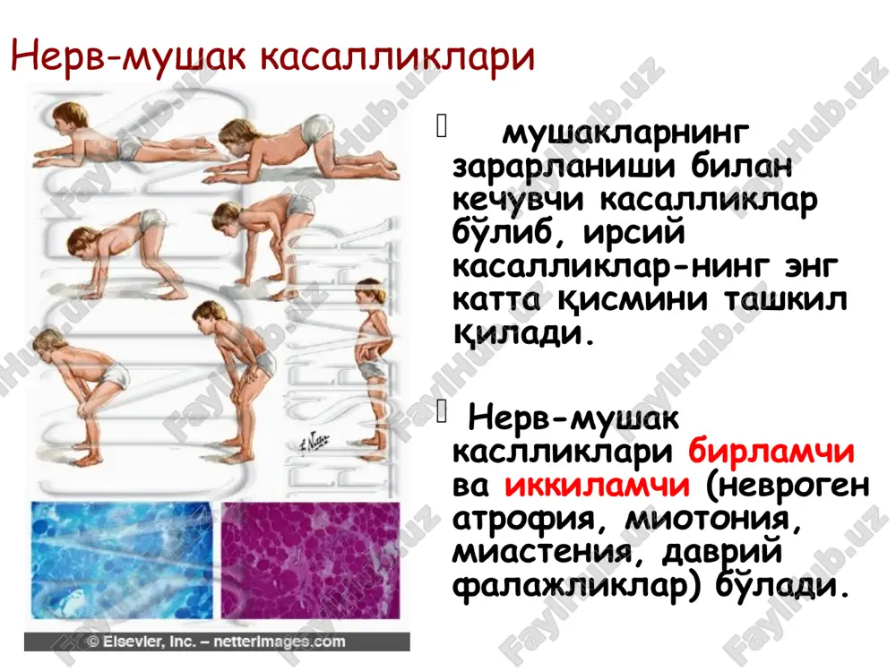 asab tizimining nasliy kasalliklarini - Page 5