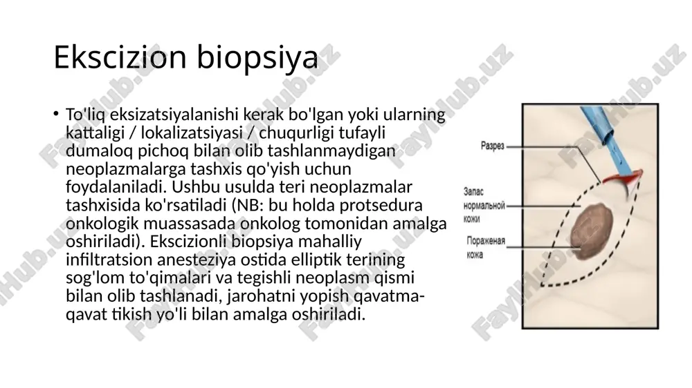 radi: lidokain, trimekain, mepivakain, prilokain, bupivakain, etidokain, artikain, anilokain, ropivakain. mahalliy anestetikalar asab impulslarining tarqalishi uchun zarur bo'lgan asab membranasining depolarizatsiyasini oldini oladi. yuzaki anesteziya yuzaki anesteziya (terminal, aloqa, dastur) eng oddiy va eng maqbul usul. bunga shilliq qavatiga lokal anesteziya eritmasini aerozol, moylash, tomizish, surtish orqali qo'llash orqali erishiladi. bunday holatda og'riq sezgirligi faqat shilliq qavat ichida yo'q qilinadi, bu esa operatsiyalarni amalga oshirishga imkon beradi. shu maqsadda 0,5-3% dikain eritmasi, 5% lidokain eritmasi, 5% trimekain eritmasi, 0,5-2% piromekain eritmasi, 2% mepivakamin eritmasi ishlatiladi. yuzaki (terminal) anesteziya qilish texnikasi sodda va moylash, eritmani tomizish yoki maxsus purkagich moslamalari yordamida purkashdan iborat. mahalliy og'riqsizlantiruvchi moddalarning yuqori konsentratsiyasini hisobga olgan holda, dozani oshirib yuborishdan saqlanish kerak. terminal anesteziya oftalmologiya, otorinolaringologiya, stomatologiya, urologiya, ginekologiya, pulmonologiya, gastroenterologiyada diagnostika va tibbiy muolajalar va manipulyatsiyalarni (bronxoskopiya, fibrogastroskopiya, kateterizatsiya, biopsiya olish va boshqalar) amalga oshirishda qo'llaniladi. aksiya nosiseptiv retseptorlarning blokadasi bilan bog'liq. infiltrasyon anesteziya tavsiya etilgan …