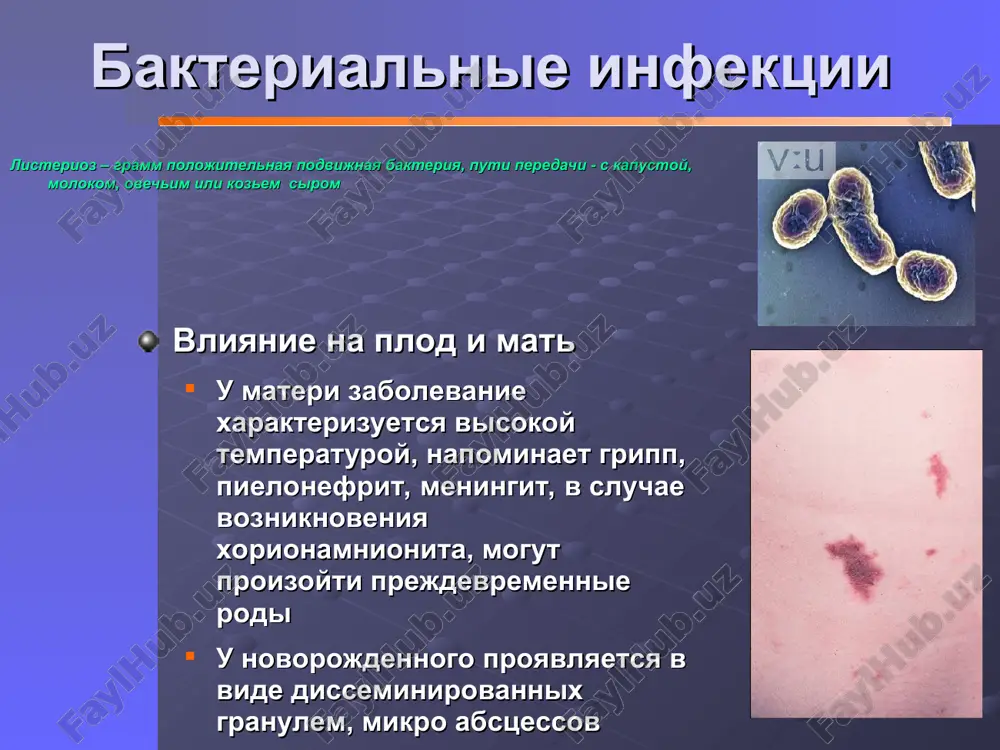 svoeobraznaya kombinatsiya simptomov virus immunodefitsita – * virusnie infektsii meri predostorojnosti kesarevo sechenie mojet ponizit risk infitsirovaniya v sluchae, esli tseli obolochki ploda epiziotomiya mojet bit sopryajena s bolee visokim riskom vpmr krovotechenie v rodax – nekotorie issledovaniya demonstriruyut povishenniy risk peredachi infektsii invazivniy monitoring sostoyaniya ploda pri rojdenii dvoyni – u pervogo rebenka vishe risk infitsirovaniya vich, chem u vtorogo virus immunodefitsita - * sxema lecheniya antiretrovirusnimi preparatami do rodov vo vremya rodov posle rodov nevirapin 1-kratno 200mg proralno s nachalom rodovoy deyatelnosti 1-kratno 2mg/kg v techenie 72 chasov s momenta rojdeniya zidovudin (zdv, azt) kratkiy kurs 300mg peroralno 2xden nachinaya s 36 nedeli 300mg peroralno kajdie 3 chasa s nachala sxvatok do rodorazresheniya dlitelniy kurs 100mg peroralno 5xden ili 200mg peroralno 3xden ili 300mg peroralno dvajdi v den v period 14-34 nedel beremennosti 2mg/kg v/v v techenie 1-go chasa, zatem 1mg/kg/chas v/v vplot do rodorazresheniya rebenku - 2mg/kg …