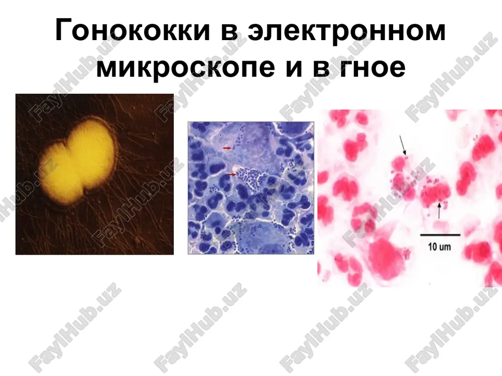 otiki gruppi penitsillina, tetratsiklini , xinoloni. problema - v razvitii rezistentnosti gonokokkov trixopol – naznachaetsya v svyazi so sposobnostyu gonokokkov razmnojatsya v organizmax prosteyshix pri neperenosimosti antibiotikov naznachayut kombinirovannie sulfanilamidnie preparati. sleduet uchitivat, chto v 30% sluchaev odnovremenno mogut obnarujivatsya xlamidii odnovremenno s antibiotikoterapiey dlya povisheniya rezistentnosti organizma primenyayut immunoterapiyu. provodyat kurs lecheniya gonovaktsinoy (vzves ubitix gonokokkov), vvodyat razlichnie immunomoduliruyushie preparati.