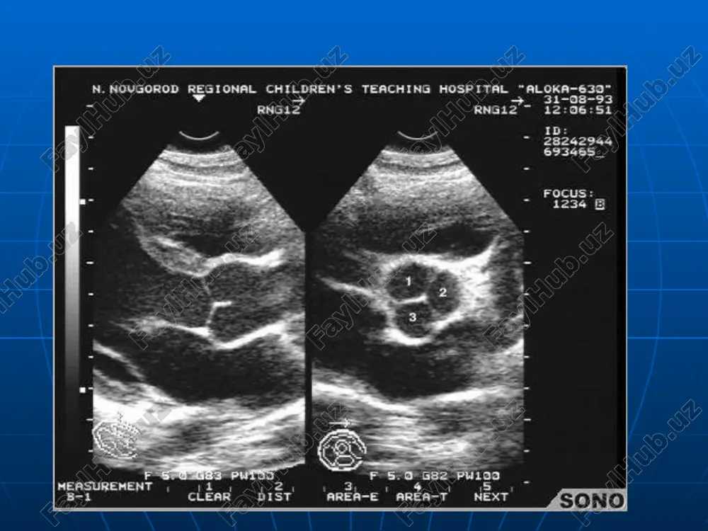 sonografiya (exokardiografiya) - Page 5