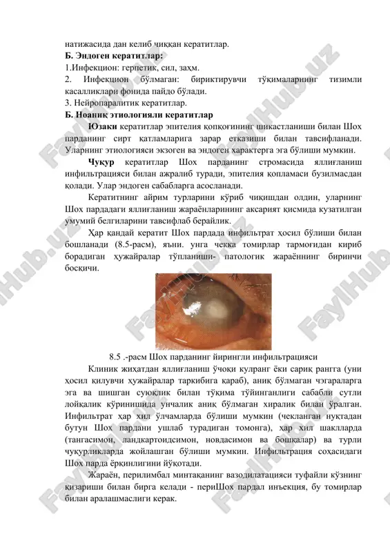 eliya qopqog'ining shikastlanishi bilan shox pardaning sirt qatlamlariga zarar etkazishi bilan tavsiflanadi. ularning etiologiyasi ekzogen va endogen xarakterga ega bo'lishi mumkin. chuqur keratitlar shox pardaning stromasida yallig'lanish infiltratsiyasi bilan ajralib turadi, epiteliya qoplamasi buzilmasdan qoladi. ular endogen sabablarga asoslanadi. keratitning ayrim turlarini ko'rib chiqishdan oldin, ularning shox pardadagi yallig'lanish jarayonlarining aksariyat qismida kuzatilgan umumiy belgilarini tavsiflab beraylik. har qanday keratit shox pardada infiltrat hosil bo'lishi bilan boshlanadi (8.5-rasm), ya'ni. unga chekka tomirlar tarmog'idan kirib boradigan hujayralar to'planishi- patologik jarayonning birinchi bosqichi. 8.5 .-rasm shox pardaning yiringli infiltratsiyasi klinik jihatdan yallig'lanish o'choqi kulrang yoki sariq rangga (uni hosil qiluvchi hujayralar tarkibiga qarab), aniq bo'lmagan chegaralarga ega va shishgan suyuqlik bilan to'qima to'yinganligi sababli sutli loyqalik ko'rinishida unchalik aniq bo'lmagan xiralik bilan o'ralgan. infiltrat har xil o'lchamlarda bo'lishi mumkin (cheklangan nuqtadan butun shox pardani ushlab turadigan tomonga), har xil shakllarda (tangasimon, landkartoidsimon, novdasimon va boshqalar) va turli chuqurliklarda joylashgan bo'lishi mumkin. infiltratsiya …